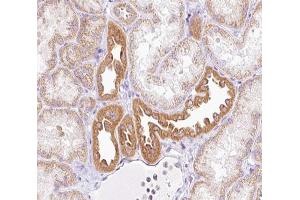ABIN6266891 at 1/100 staining human kidney tissue sections by IHC-P. (NRIP2 抗体  (N-Term))