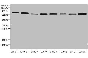 Western blot All lanes: Protein argonaute-2 antibody at 2 μg/mL Lane 1: A549 whole cell lysate Lane 2: Jurkats whole cell lysate Lane 3: MCF-7 whole cell lysate Lane 4: HepG2 whole cell lysate Lane 5: Raw264. (AGO2 抗体  (AA 517-818))