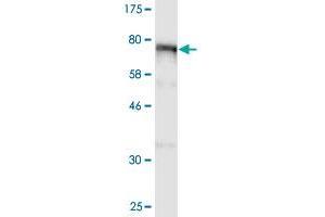 Western Blot detection against Immunogen (98. (ALOX15 抗体  (AA 1-662))