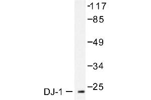 Image no. 1 for anti-Parkinson Protein 7 (PARK7) antibody (ABIN265384) (PARK7/DJ1 抗体)