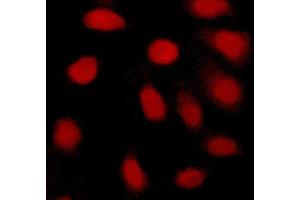 ABIN6269077 staining Hela cells by ICC/IF. (c-MYC 抗体  (N-Term))