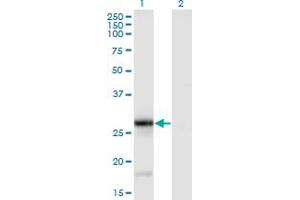Western Blot analysis of TNFSF9 expression in transfected 293T cell line by TNFSF9 monoclonal antibody (M01), clone 1D7. (TNFSF9 抗体  (AA 145-254))