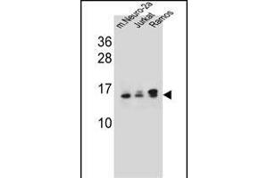 UBE2E2 Antibody (N-term) (ABIN657745 and ABIN2846729) western blot analysis in mouse Neuro-2a,Jurkat,Ramos cell line lysates (35 μg/lane). (UBE2E2 抗体  (N-Term))