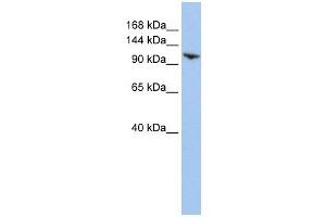 RNF20 antibody used at 1 ug/ml to detect target protein. (RNF20 抗体  (N-Term))
