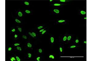 Immunofluorescence of purified MaxPab antibody to HN1L on HeLa cell. (HN1L 抗体  (AA 1-190))