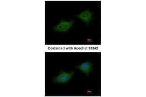 ICC/IF Image Immunofluorescence analysis of methanol-fixed HeLa, using MMP3, antibody at 1:200 dilution. (MMP3 抗体)