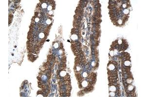 PGRMC1 antibody was used for immunohistochemistry at a concentration of 4-8 ug/ml to stain EpitheliaI cells of intestinal villus (arrows) in Human Intestine. (PGRMC1 抗体  (N-Term))