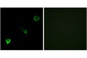 Immunofluorescence analysis of COS7 cells, using TYK2 (Ab-1054) Antibody. (TYK2 抗体  (AA 1020-1069))