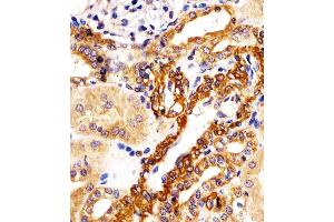 (ABIN6242941 and ABIN6578201) staining KIF22 in human kidney tissue sections by Immunohistochemistry (IHC-P - paraformaldehyde-fixed, paraffin-embedded sections). (KIF22 抗体  (AA 423-456))