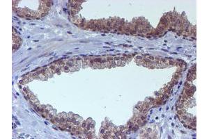 Image no. 1 for anti-RuvB-Like 2 (E. Coli) (RUVBL2) (AA 113-370) antibody (ABIN1490851) (RUVBL2 抗体  (AA 113-370))