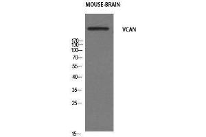 Western Blotting (WB) image for anti-Versican (Vcan) (N-Term) antibody (ABIN3187467) (Versican 抗体  (N-Term))