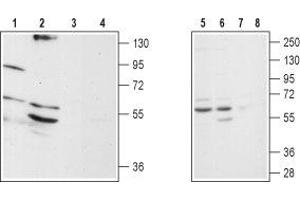 Western blot analysis of rat brain stem (lanes 1 and 3), mouse brain (lanes 2 and 4), SH-SY5Y (lanes 5 and 7) and Jurkat (lanes 6 and 8) lysates: - 1,2,5,6. (ADRA1D 抗体  (C240S, Extracellular))