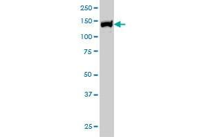 UBE4B monoclonal antibody (M01), clone 8F9 Western Blot analysis of UBE4B expression in Hela S3 NE . (UBE4B 抗体  (AA 1075-1173))