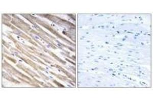 Immunohistochemistry analysis of paraffin-embedded human heart tissue using RPL3L antibody. (RPL3L 抗体)