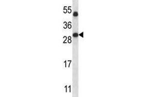 SIRT5 antibody western blot analysis in human placenta tissue lysate. (SIRT5 抗体  (AA 99-127))
