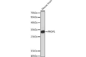 Western blot analysis of extracts of Mouse brain, using PROP1 Rabbit pAb (ABIN7269568) at 1:1000 dilution. (PROP1 抗体  (AA 50-150))