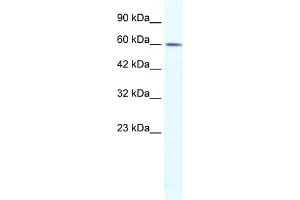 WB Suggested Anti-TRIM3 Antibody Titration:  1. (TRIM3 抗体  (N-Term))