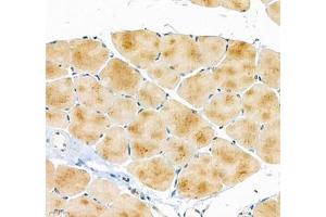 Immunohistochemistry of paraffin embedded mouse skeletal muscle using ATP2A2 (ABIN7075545) at dilution of 1: 500 (400x lens) (SERCA2 ATPase 抗体)