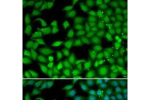 Immunofluorescence analysis of MCF-7 cells using RTKN Polyclonal Antibody (Rhotekin 抗体)