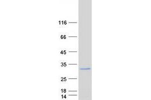 Validation with Western Blot