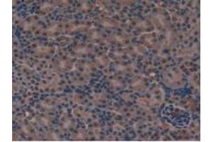 IHC-P analysis of Mouse Kidney Tissue, with DAB staining. (FLT4 抗体  (AA 30-326))