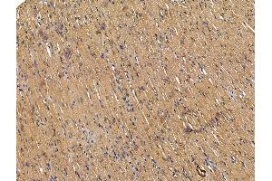 ABIN7094625 and ABIN7098675 at 1/100 staining Rat heart tissue by IHC-P. (FZD4 抗体  (Internal Region))