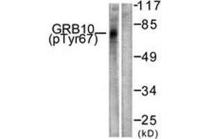 Western Blotting (WB) image for anti-Growth Factor Receptor-Bound Protein 10 (GRB10) (AA 33-82), (pTyr67) antibody (ABIN1531649)