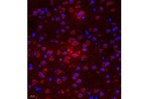 Immunofluorescence of paraffin embedded mouse brain using UTS2 (ABIN7076162) at dilution of 1:2000 (400x lens) (Urotensin 2 抗体)
