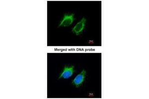 ICC/IF Image Immunofluorescence analysis of paraformaldehyde-fixed HeLa, using Inhibin beta-A , antibody at 1:200 dilution. (INHBA 抗体  (C-Term))
