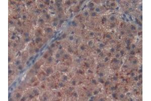 Immunohistochemistry (IHC) image for anti-N-Methylpurine-DNA Glycosylase (MPG) (AA 221-296) antibody (ABIN7436513)
