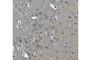 IHC analysis of SCG10/STMN2 using anti-SCG10/STMN2 antibody (ABIN7600734).