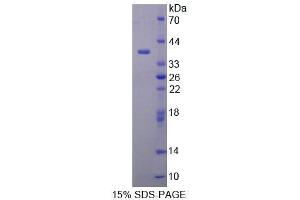 SDS-PAGE analysis of Human MYB Protein. (MYB 蛋白)