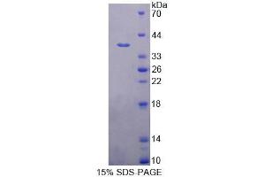 SDS-PAGE analysis of Human PLSCR4 Protein.
