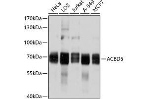 Western blot analysis of extracts of various cell lines, using  antibody (ABIN6131213, ABIN6136419, ABIN6136420 and ABIN6214901) at 1:1000 dilution.