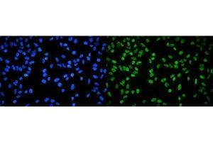 IF analysis of RPA32/RPA2 using anti-RPA32/RPA2 antibody (ABIN7601380). (RPA2 抗体  (AA 34-254))
