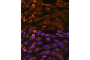Immunofluorescence analysis of C6 cells using PTCH1 antibody (ABIN1682368, ABIN1682367, ABIN3015342, ABIN3015343 and ABIN6213997) at dilution of 1:100. (Patched 1 抗体  (AA 1214-1312))
