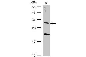 WB Image Sample(30 ug whole cell lysate) A:293T 12% SDS PAGE antibody diluted at 1:2000 (UROS 抗体)