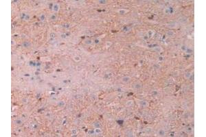 Detection of CAPN1 in Rat Spinal Cord Tissue using Polyclonal Antibody to Calpain 1 (CAPN1) (CAPN1 抗体)