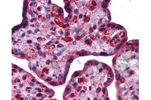 Anti-DLX6 antibody IHC of human placenta. (DLX6 抗体  (AA 36-85))