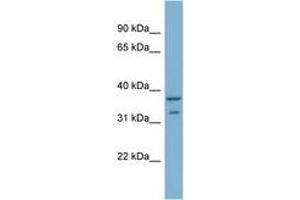 Image no. 1 for anti-Ral GEF with PH Domain and SH3 Binding Motif 2 (RALGPS2) (AA 201-250) antibody (ABIN6742101) (RALGPS2 抗体  (AA 201-250))