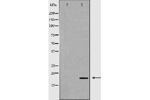 Western blot analysis of extracts of fetal brain, using THY1 antibody. (CD90 抗体  (Internal Region))