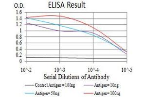 Black line: Control Antigen (100 ng),Purple line: Antigen (10 ng), Blue line: Antigen (50 ng), Red line:Antigen (100 ng) (FOXP2 抗体  (AA 641-740))