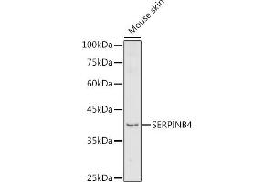 Western blot analysis of extracts of Mouse skin, using SERPINB4 antibody (ABIN7270243) at 1:1000 dilution. (SERPINB4 抗体  (C-Term))