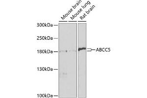 Western blot analysis of extracts of various cell lines, using  antibody (ABIN3017213, ABIN3017214, ABIN3017215 and ABIN6219998) at 1:1000 dilution.
