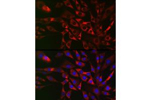 Immunofluorescence analysis of NIH/3T3 cells using TRIP2 Rabbit pAb (ABIN6129947, ABIN6149464, ABIN6149465 and ABIN6222516) at dilution of 1:50 (40x lens). (TRAF3IP2 抗体  (AA 1-300))