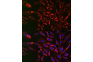Immunofluorescence analysis of NIH/3T3 cells using TRIP2 Rabbit pAb (ABIN6129947, ABIN6149464, ABIN6149465 and ABIN6222516) at dilution of 1:50 (40x lens). (TRAF3IP2 抗体  (AA 1-300))