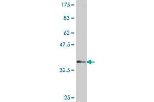 Western Blot detection against Immunogen (37 KDa) . (Mare/Nprl3/C16orf35 抗体  (AA 470-568))