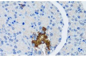 Immunohistochemistry of paraffin-embedded Rat pancreatic islet using TSC1 Polyclonal Antibody at dilution of 1:200 (40x lens). (TSC1 抗体)