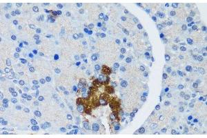 Immunohistochemistry of paraffin-embedded Rat pancreatic islet using TSC1 Polyclonal Antibody at dilution of 1:200 (40x lens).