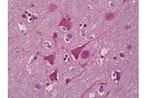 Anti-EPHX2 antibody IHC of human brain, cortex neurons. (EPHX2 抗体)